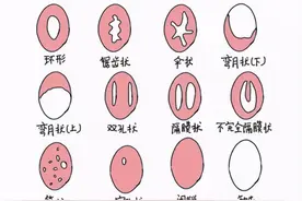 处女用卫生棉条，一定会出血？破坏那层膜？这里面有太多误解图片