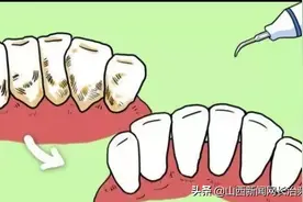 长治市第二人民医院：看牙如何省钱？快来get一下省钱小妙招图片