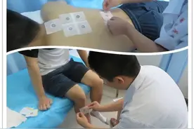 「冬病夏治」善用天时固阳气，三伏“天灸”防痼疾图片