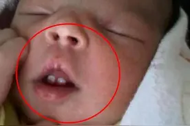 女子结婚6年终怀孕，孩子一出生就有3颗牙，医生斥责：不配当妈图片