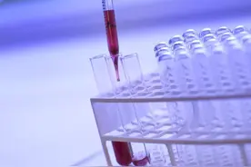 肝功能转氨酶指标高，到底严不严重？问题可大可小，要看致病原因图片
