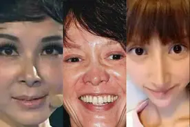 整容失败女星盘点，眼大脸尖似外星人，回炉重造最终全脸崩盘图片