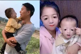 妈妈“鸟脸”遗传 下一代| 有严重基因缺陷要不要生孩子图片