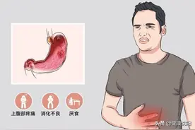 健康科普堂 | 胃痛就一定要做胃镜检查吗？图片
