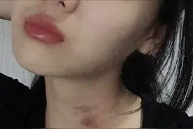 曝23岁歌手私生活混乱，被女友指控家暴出轨还动刀，本人退赛回应图片