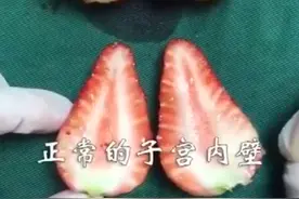世界避孕日：10 个羞羞的问题，成年男女都要清楚图片