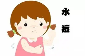 水痘，儿童容易中招，这些战“痘”知识赶紧备好图片