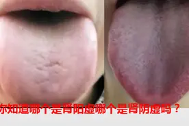 养肾找地黄丸，地黄丸家族成员多，肾阴虚、肾阳虚不要选错了图片