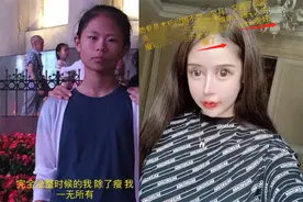 15岁花400万整容，满是悔意实则谎话连篇，少女网红的“变脸史”图片