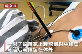 看着都疼！在家玩弩箭竟射中自己心口 离心脏仅1厘米图片