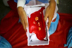 几个月大的胎儿算是人？科学家们对此争论百年图片