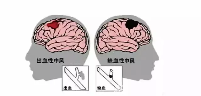 小分子肽对心脏的作用 2026年最新小分子肽对心脏的作用