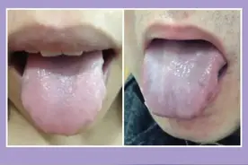 分享9种体质舌象，让老中医教你辨证，后面给你解决方法图片