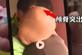 “三鹿奶粉”重出江湖？湖南现大头娃娃，购买奶粉需注意图片