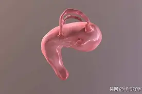 「专家说」单角子宫不孕患者，要注意到哪些情况？图片