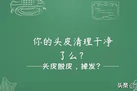 你的头皮清理干净了么？图片