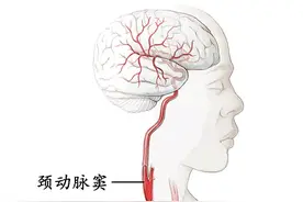 脖子上的这个穴，不懂千万不要摁！图片