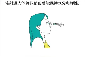肉毒素真有毒，那玻尿酸是不是真有尿？图片