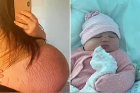 英国女子诞下近12斤重女婴，孕肚绷到流血，生产过程超24小时图片
