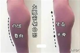 大腿前侧凸出影响美观？股四头肌成了背锅侠，它也只是受害者而已图片