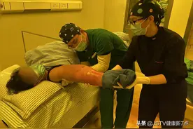 血透肾友上肢肿胀如小腿，专家攻坚克难让她重获新生图片