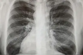 总有些人“天赋异禀”，看看你是否是那个天选之人图片