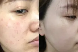 为什么专家建议防晒霜尽量少用？更不要每天涂，不仅没用反倒有害图片