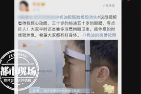 太吓人！“30岁的人50岁的眼睛”男演员被查出眼睛睑板腺消失图片