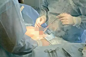 剖腹产时，可以让医生清脂吗？医生：只有这两种情况会“顺带”做图片
