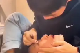 哭笑不得！山东一男生给室友摘隐形眼镜，下一秒口水滴进室友嘴里图片