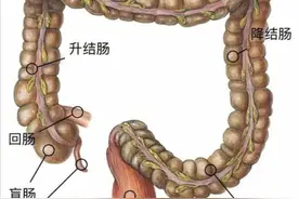 肠癌最怕什么运动？怎么预防？图片