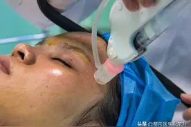 看起来比同龄人年轻10岁，这些医美抗衰项目少不了图片