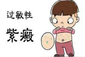 过敏性紫癜是一种怎样的疾病？这几种病一定不要混淆图片