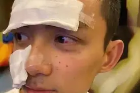 吴磊脸被炸花，易烊千玺筋断了，相比之下鞠婧祎的带伤拍戏太可笑图片