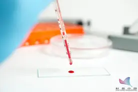 电视剧中的"滴血认亲"有科学依据吗？从小看到大，终于知道真相了图片