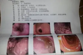 得了胃溃疡应该怎么调理？图片