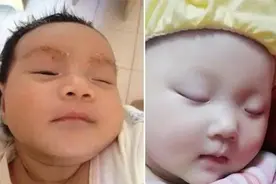 奶奶给满月孙女剃光眉毛，2个月后家人以泪洗面，网友：迷信害人图片