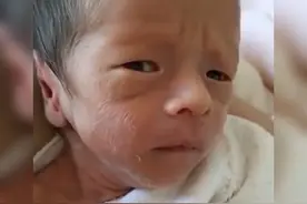 刚生下来的丑娃不要扔！没准儿过几天他就长开了，网友：堪比换头图片