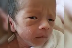 刚生下来的丑娃不要扔！没准儿过几天他就长开了，网友：堪比换头图片