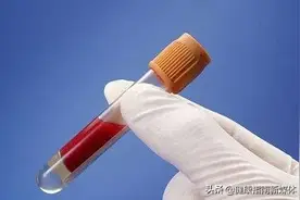 乙肝的检测图片