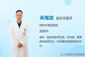 #健康科普排位赛# 头发脂溢性皮炎怎么办？图片