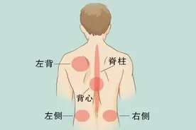 后背疼与多种病有关！一张「疼痛位置图解」看得明明白白图片