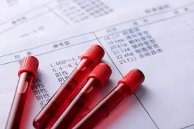 你只需要看染色体检查的最终结果#健康科普排位赛#图片