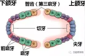 牙医解密：为什么医生喜欢让你拔智齿？图片