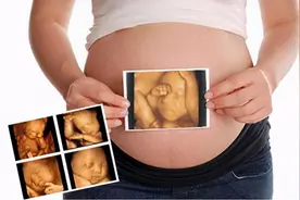 怀孕4个月都能感受到胎动？这4类孕妈妈，感受胎动可能会晚一点图片