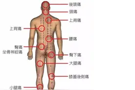 最全！身体疼痛对照表，请对号入座！看看你到底是哪儿堵了？图片