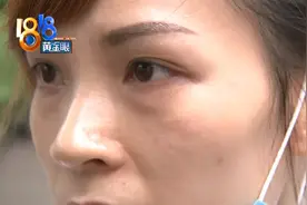去“永琪”理发，查出有汗管瘤？吓得赶紧花16800做护理图片