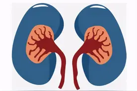 人体切除一个肾有什么影响？图片
