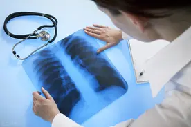 拿到肺部检查报告后，应该找谁（哪个科）看呢？图片