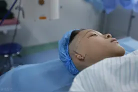 孩子没有耳朵怎么办？外耳再造术可以帮助你！图片